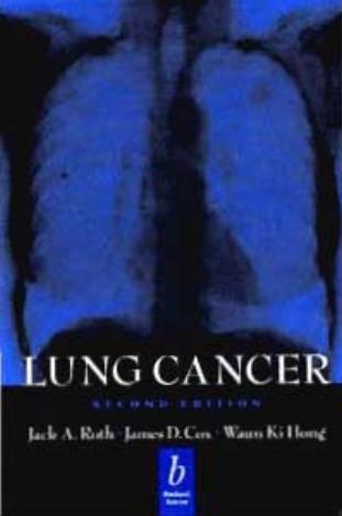 Lung Cancer, Second Edition