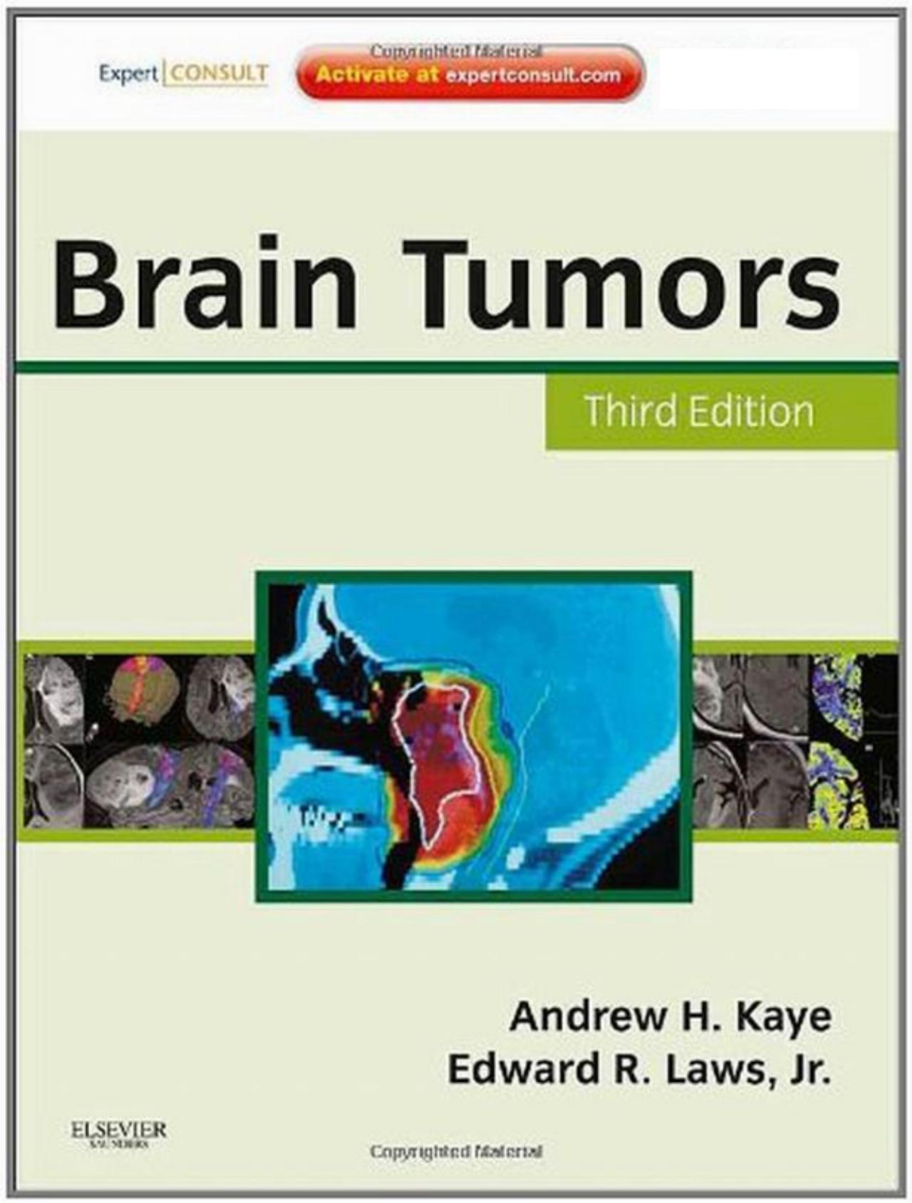 Brain Tumors An Encyclopedic Approach 3rd Edition